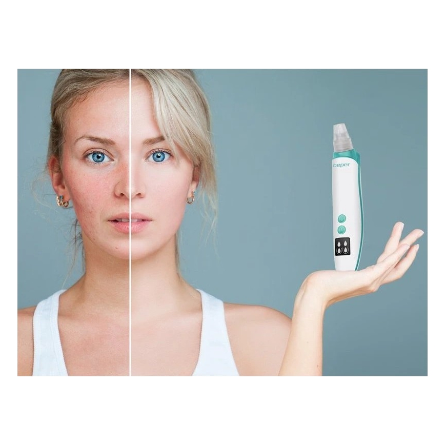 Beper - Įkraunamas porų valiklis USB/5V 400 mAh