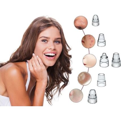 Beper - Įkraunamas porų valiklis USB/5V 400 mAh