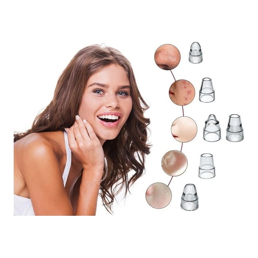 Beper - Įkraunamas porų valiklis USB/5V 400 mAh