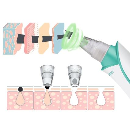 Beper - Įkraunamas porų valiklis USB/5V 400 mAh